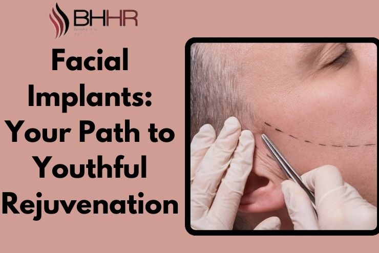 facial implants